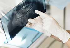Root Canal Treatment
