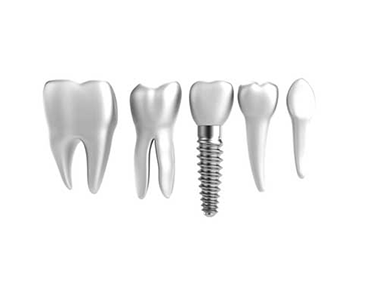 Dental implants